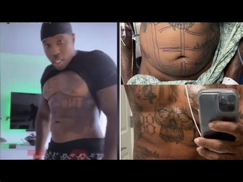 bandman kevo before and after surgery|From 58 to 68: Bandman Kevos Height Surgery Transformation!